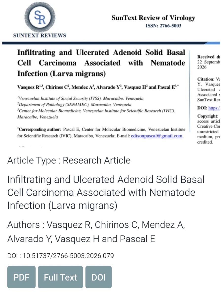 edisonpascal's tweet photo. Nuestro trabajo de investigación sobre carcinoma baso celular asociado a infección con #nematodos #parasitologia #IVIC https://t.co/RxH7kKzsoJ https://t.co/JRIOk8xLIR