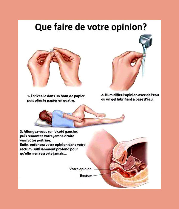 Abi_SAMCA's tweet photo. @yagamudda @marc46974088 @__PVNAME44 Ton opinion https://t.co/tbc7VRzklh