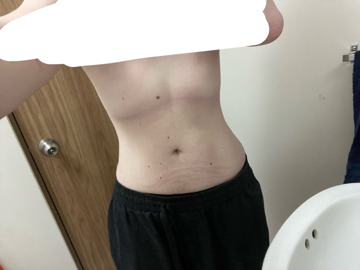 3unnyKcals's tweet photo. bmi 22.6 😣☹️ https://t.co/9WwJyQM5Td