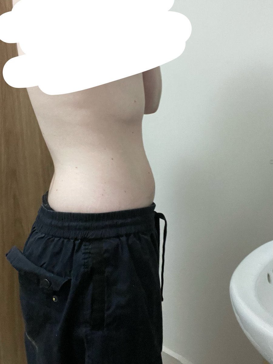3unnyKcals's tweet photo. bmi 22.6 😣☹️ https://t.co/9WwJyQM5Td