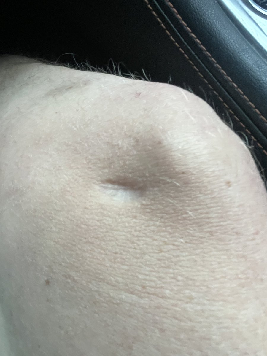 TheTickingHeart's tweet photo. I have #scars #everywhere! #collab #of #onlyfans #sex #bop #fanvue #mattressactress #riding #porn #cum #baddie #fyp #xxx #NSFW #Retweet #LinkInBio #OnlyFansModel #OnlyFansCreator #wataa #creampie #goon #gooning https://t.co/tbNnEbdtu1 https://t.co/1gDTyTH8an