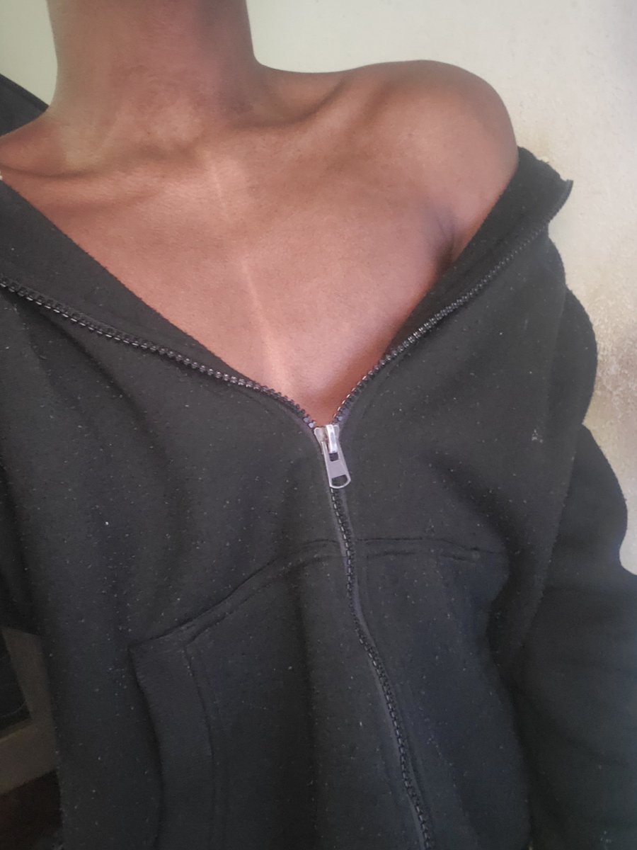 YevnoirKanzaki's tweet photo. Okay your twink post today is shoulder reveal https://t.co/Xn8cIq4tzn