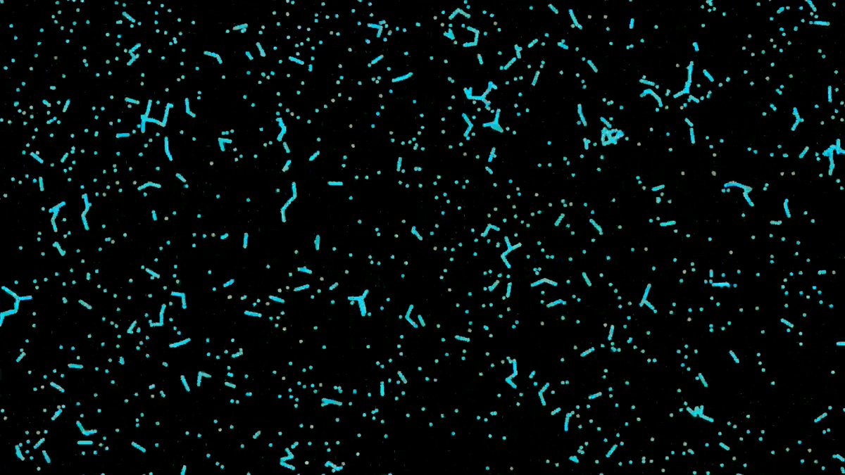 An abstract digital image featuring scattered, glowing cyan dots and short line segments distributed across a black background, resembling a starfield or data visualization.