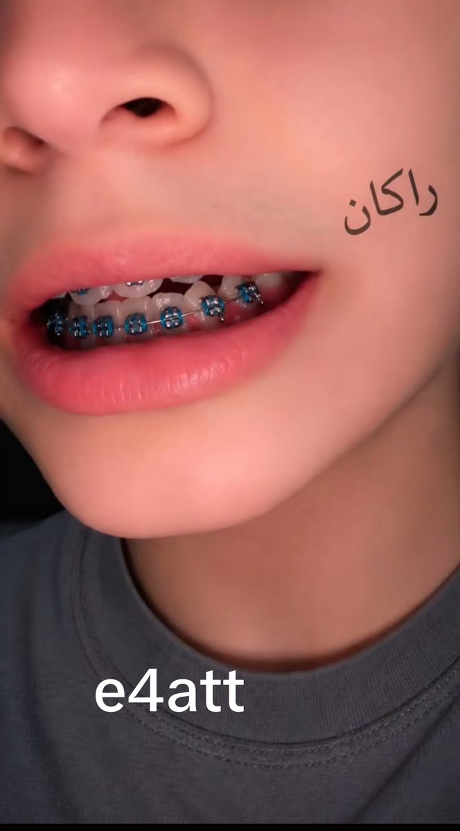 e4att's tweet photo. وش اخبار الريال وكلابي وفحولي https://t.co/fVxUIR9WoG