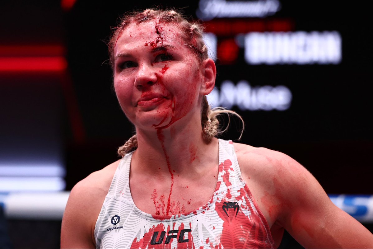 uncrownedcombat's tweet photo. A closer look at the forehead gash Alice Pereira left on Daria Zhelezniakova 😳 https://t.co/mSh6lBMNnk