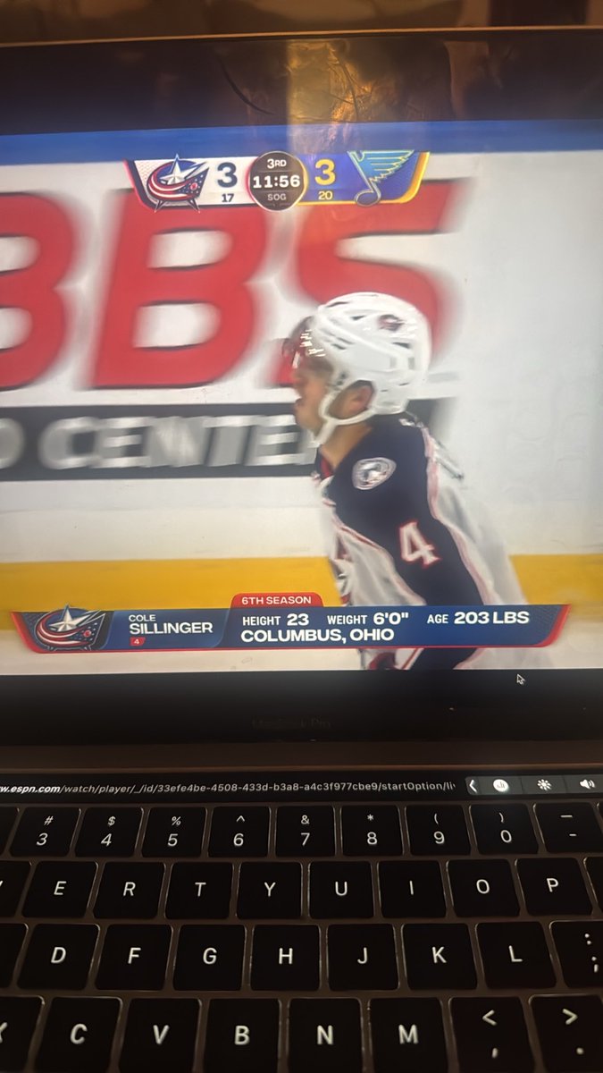 olivapologist44's tweet photo. Got a graphic mishap #cbj https://t.co/JBf7sGGzPY