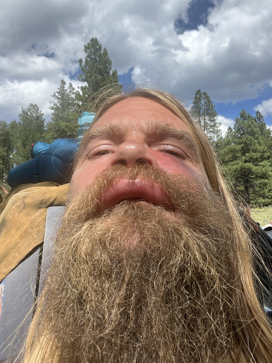omphaloskepsis0's tweet photo. @radioactivered I learned that my upper lip is the center of the universe https://t.co/CHcdp1vYK6