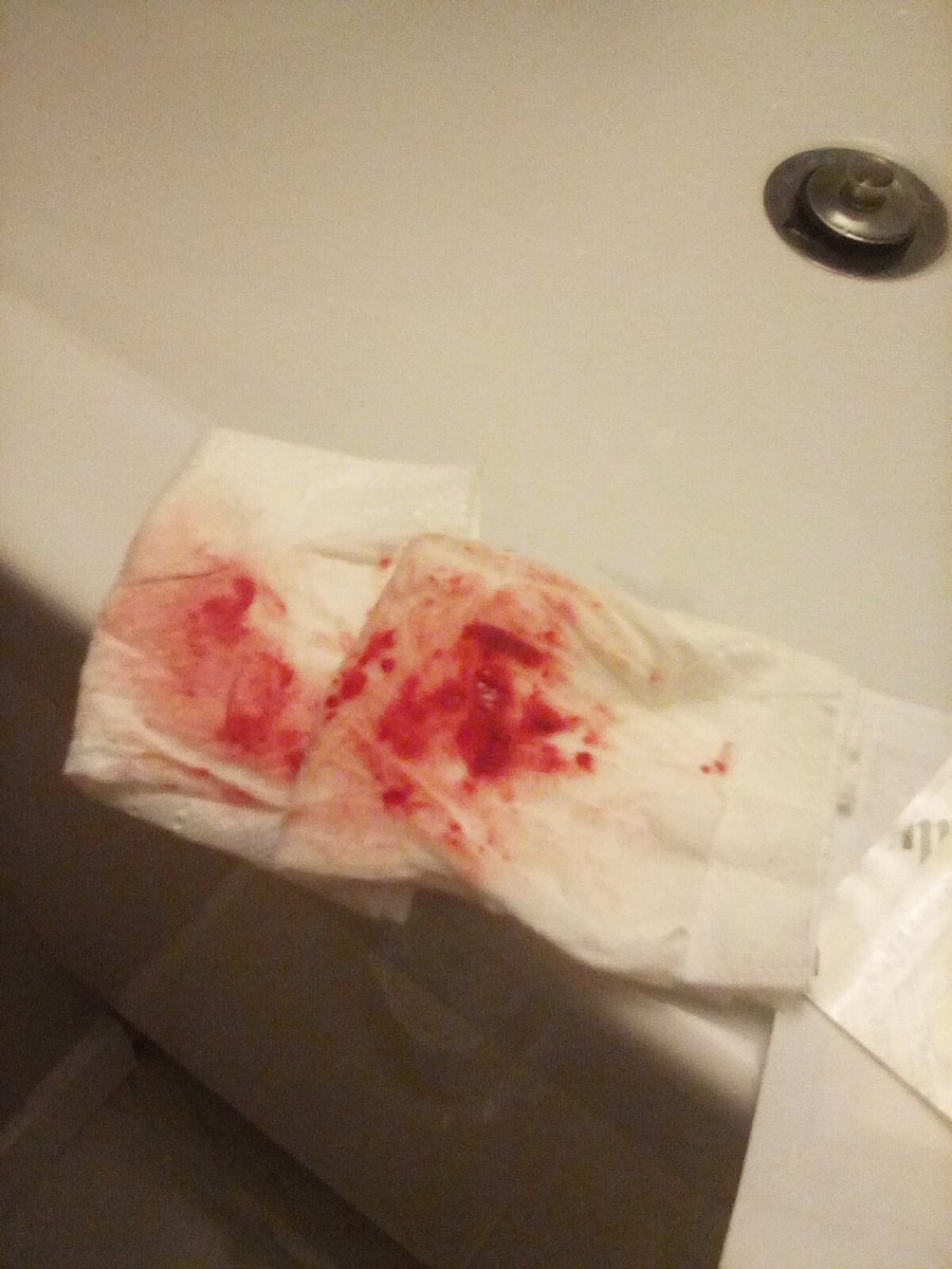 Fallen_duckk's tweet photo. ⚠FAKE SFX HALLOWEEN MAKEUP MADE WITH AI⚠
⏔⏔⏔ ꒰ ᧔ෆ᧓ ꒱ ⏔⏔⏔
Elon please don't slime me <(ꐦㅍ _ㅍ)>
#shtw #shtwt #catscratches #ouchietwt #sfx #halloweenmakeup https://t.co/QmSSkdxZQw