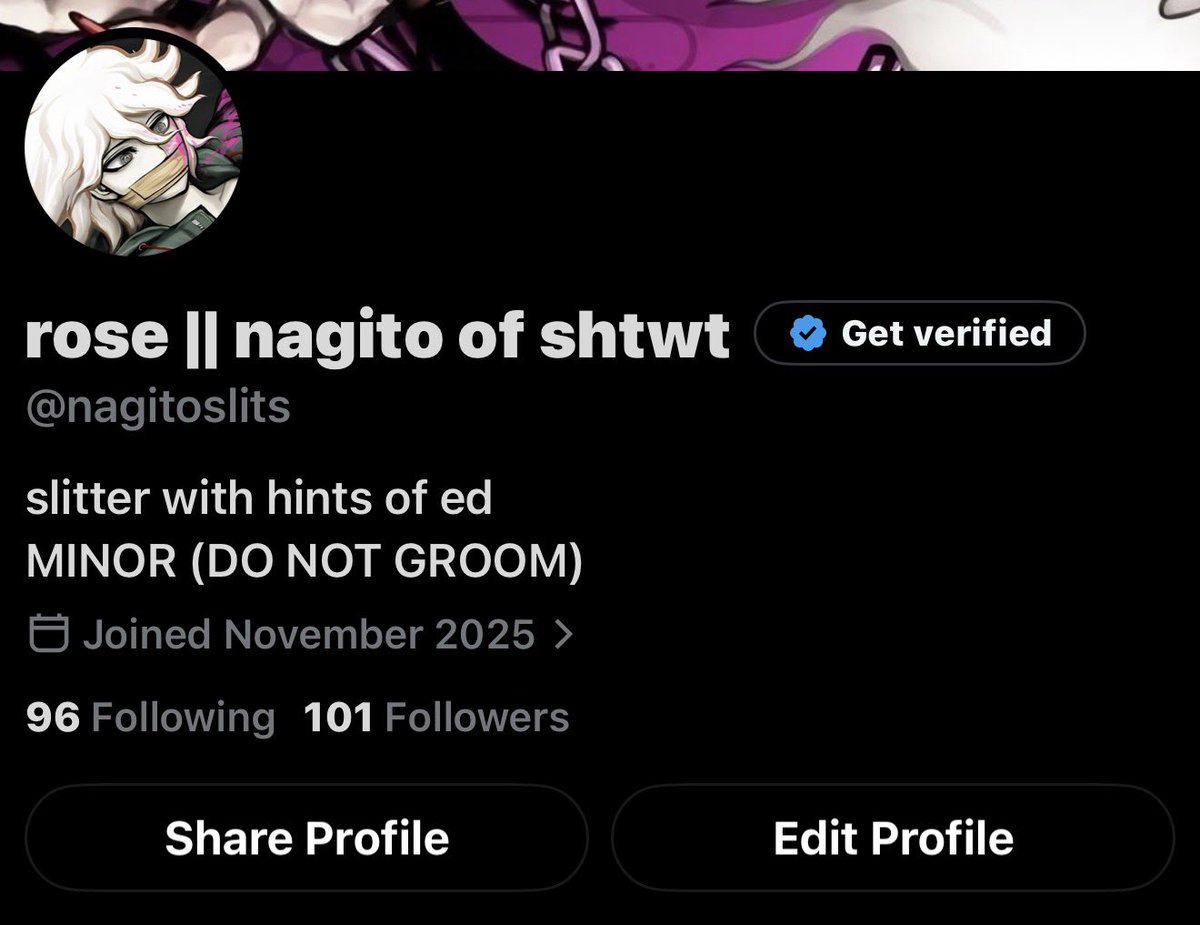 nagitoslits's tweet photo. oh my days THANK U FOR 100 FOLLOWERSSSS🥹🥹 i literally had 13 followers 4 days ago💔💔💔 i #love you guys https://t.co/TVl7xLuWCb