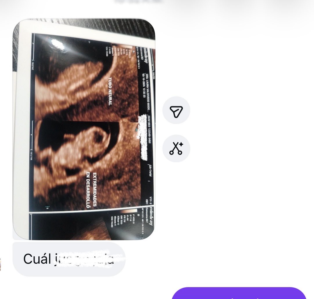 wen_babby's tweet photo. En qué momento pasamos de que esto nos asustara a que nos alegrara.
Siempre feliz por mis amiguitas 🫶🏻 https://t.co/4ZE3If3vkP