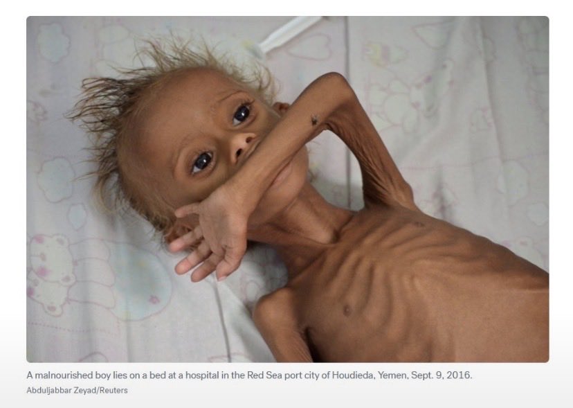 Onebigark's tweet photo. @MarkJCarney Please find the courage to speak up for the millions of people in Yemen who have endured decades of suffering, torture, and killing at the hands of oil-rich oligarchs. Their lives matter, and their voices deserve to be heard. https://t.co/AODBNvfWCA