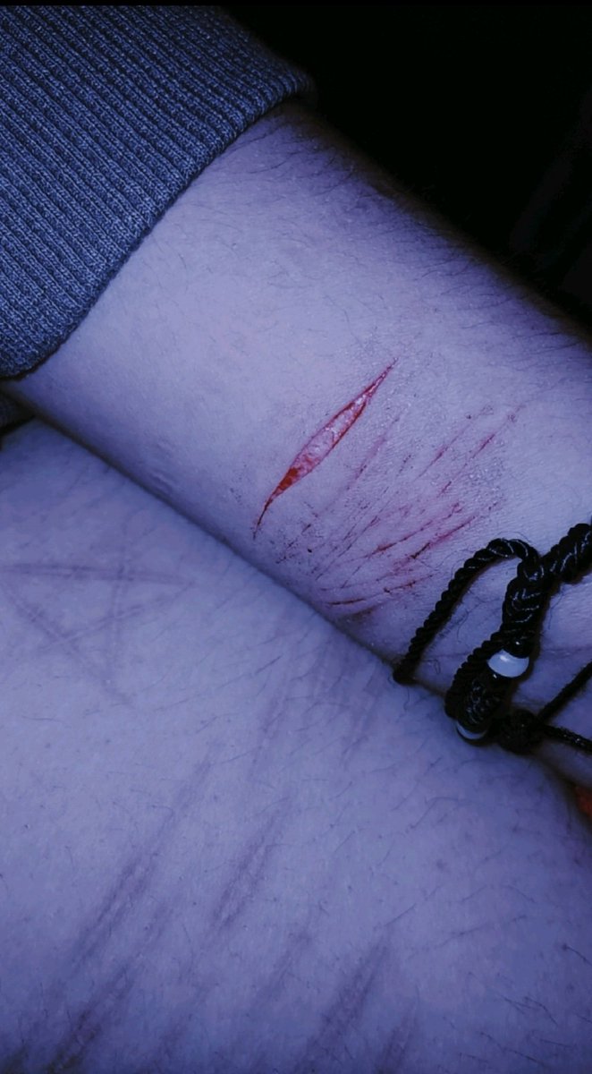 Cnocturn77's tweet photo. SFX makeup ໒꒰ྀི∩˃ ᵕ ˂∩꒱ྀི১
#cuts #sfx https://t.co/0JRhJtj5zW