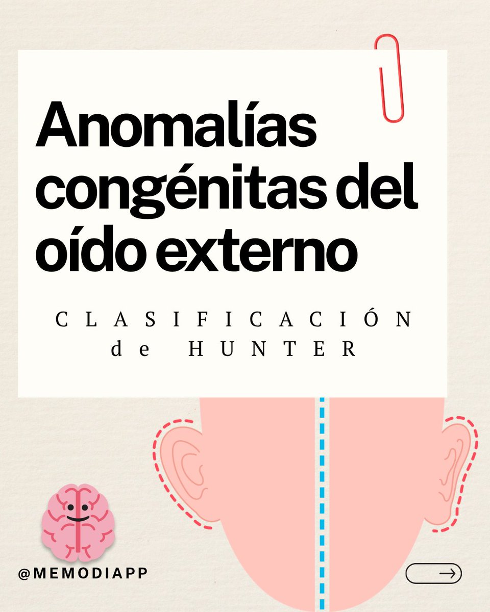 MemodiApp's tweet photo. El sistema de clasificación de Hunter describe clínicamente las anomalías congénitas del oído externo.

Hospital Infantil de México, 2014 https://t.co/8FQz3hkl1a