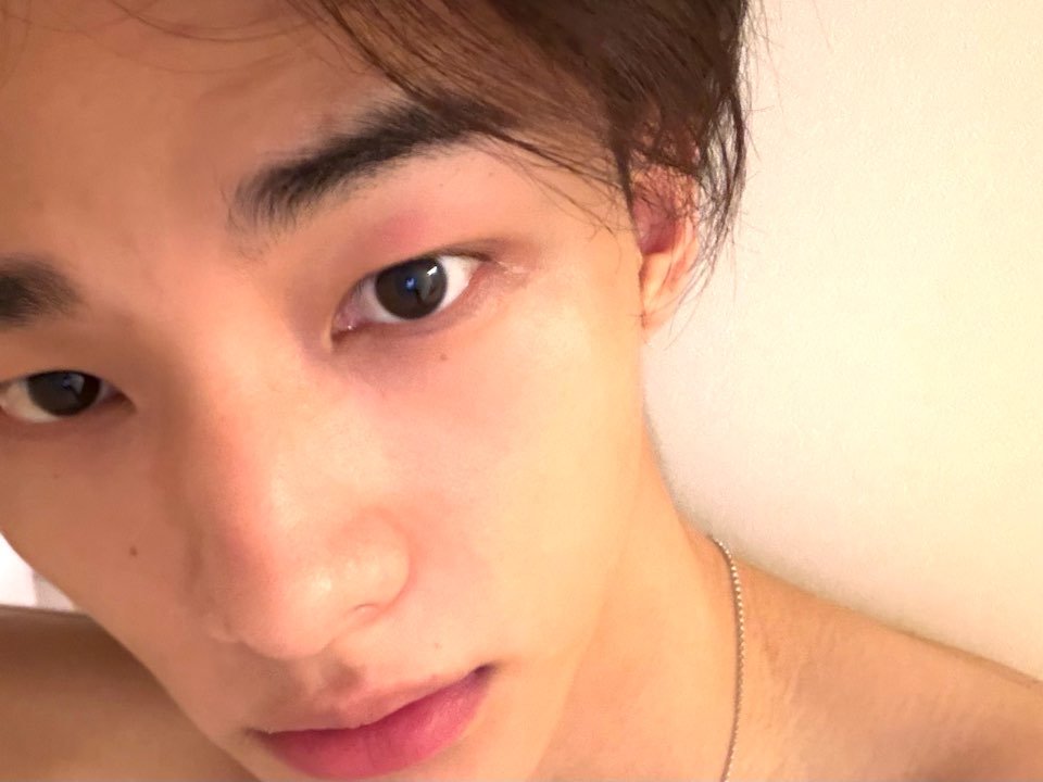 bbokseungah's tweet photo. a handsome guy showing off his mosquito bites.... ha....... https://t.co/u7i9O4gh3k