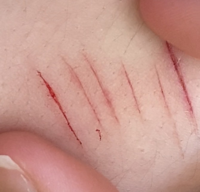 sophiaham84's tweet photo. My friend did my halloween makeup again! All fake! Sfx makeup #sfxmakeup #fake 

Guys is this a baby styro. I cant really tell but i think i saw white. Small cut tho https://t.co/6EBrrorvnp