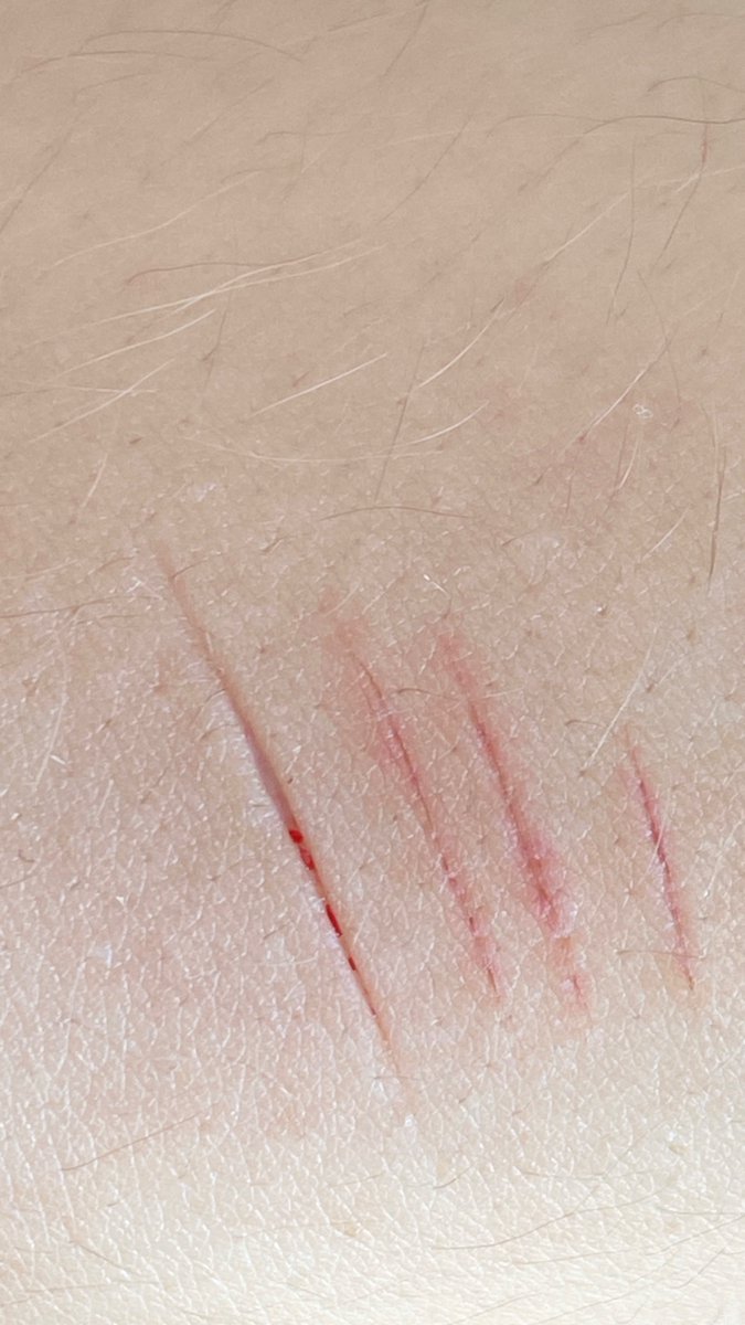 sophiaham84's tweet photo. My friend did my halloween makeup again! All fake! Sfx makeup #sfxmakeup #fake 

Guys is this a baby styro. I cant really tell but i think i saw white. Small cut tho https://t.co/6EBrrorvnp