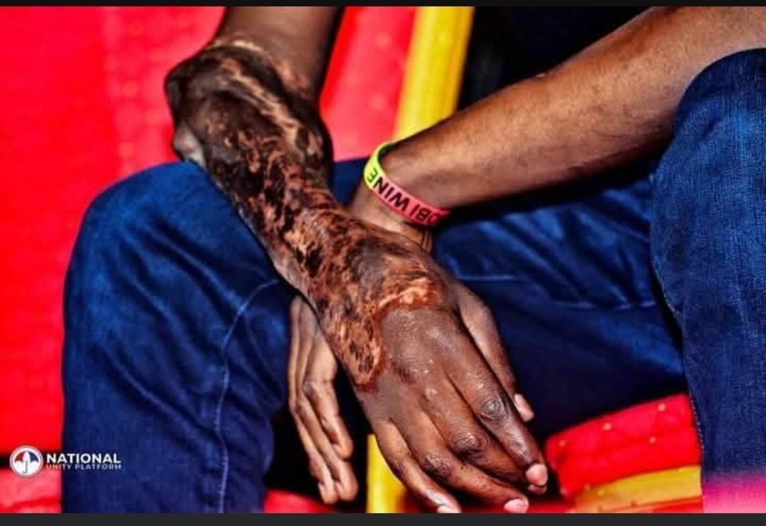 Jolynedith's tweet photo. @IntlCrimCourt ICC you arrest museveni and his son muhoozi because they are killing and torturing innocent Ugandans. https://t.co/irpFbOExtw