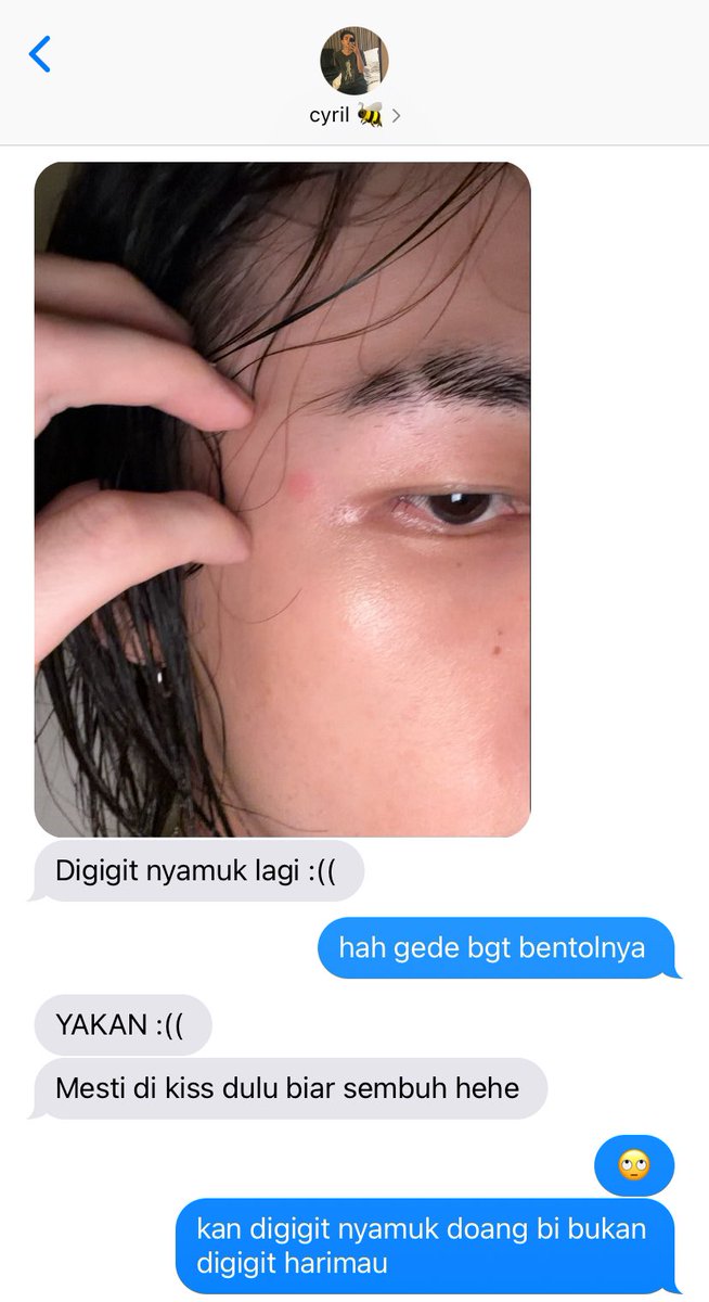 brainsickangel's tweet photo. tapi si cyril ini emg langganan bgt digigit nyamuk apakah darahnya manis (hah)

🥟🐥 lagiii https://t.co/cAyBIuonad