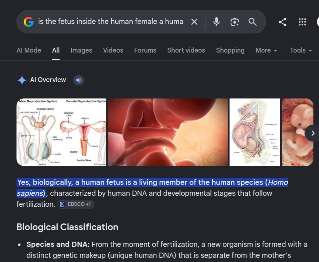 idkyrant's tweet photo. @btsarmy_237 So you are larping as a doctor , you dont even know a human female cannot concieve anything other than a human fetus , so what is it a cow fetus or a rat fetus , or u dont even know what fetus denotes https://t.co/G2VS20wnCM