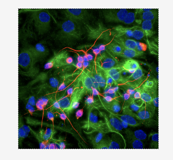 pknoepfler's tweet photo. Weekly #regenerative med reads: stem cell and peptides via RFK Jr., Urnov vs. Tie exchange fire, med centers cash in on longevity, the end for Caribou https://t.co/HgRo1mQhfC #stemcells https://t.co/lWMPBaMmiz
