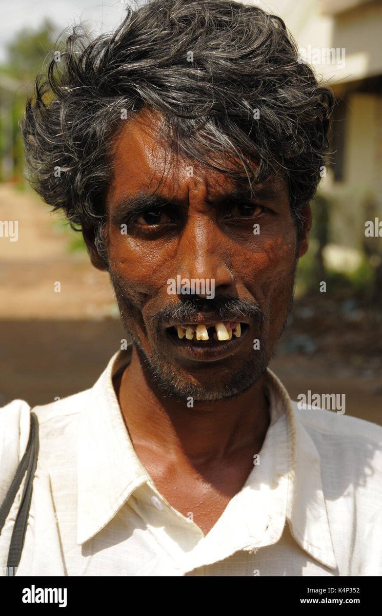 Jimi_Starwalker's tweet photo. @adityx67 @xyzstfup1 @0_BossS Okay stinky nigga what’s your point. Yall niggas are hideous ☠️😂😂😂 https://t.co/W8kumRgRid