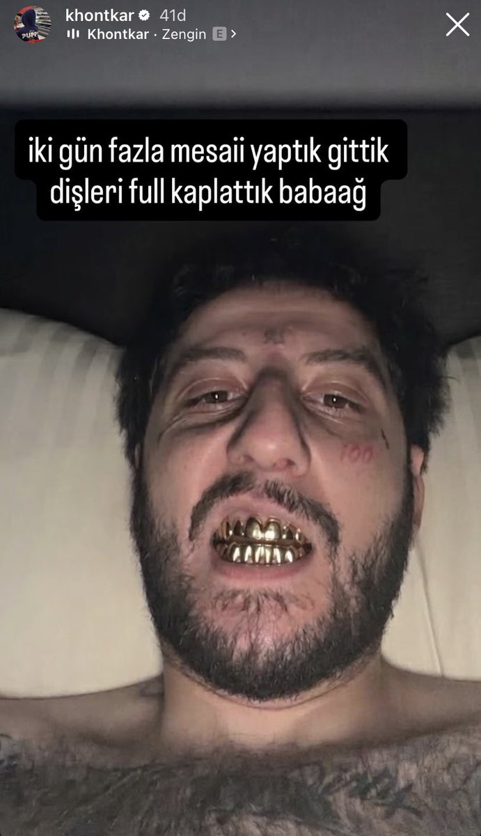 gossipmagazinn's tweet photo. Amerika’da ek iş olarak kamyonet süren Khontkar, bütün dişlerini altın kaplattı.

“İki gün fazla mesai, dişleri full kaplatırdık babağ” https://t.co/CVK4vZ5m6l