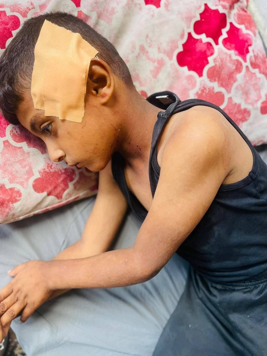 MosabAbuToha's tweet photo. Israel shot and wounded two siblings in Khan Younis. https://t.co/lBtg1ks6kX