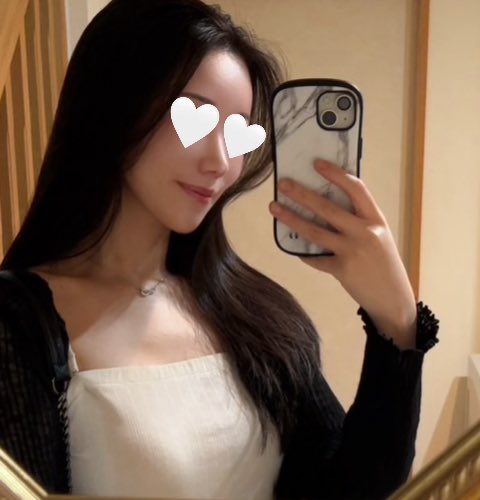 Ujq9m's tweet photo. シャープ美容外科で脂肪移植（額・こめかみ・前頬骨・頬のくぼみ部分）と糸リフトをして半年経ちました🎶
仕上がりとても満足しています☺️✨
脂肪はしっかり定着していて後戻りは全くありません！
糸リフトの効果も半年経っても変わらず実感できています😌 https://t.co/7p6fbVHhcy