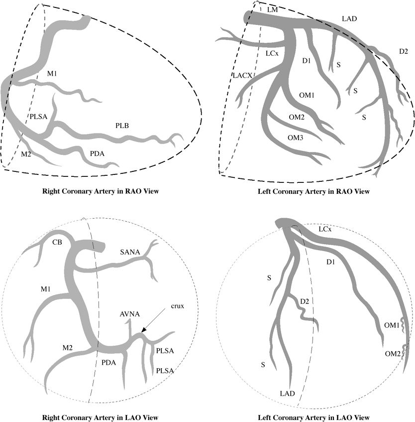 HiraaliCardio's tweet photo. Basic Coronary Arteries Anatomy For Cath !! https://t.co/nmtztvTbhD