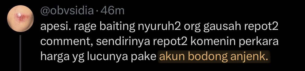 txtheya's tweet photo. apasi, so rude~

nih aku ss-in ya kakak rude yang ngetik “anj*nk”, bisa kan baca bio aku? nih aku ss-in biar kebaca

ah gamau ah dikatain bodong sama yang follsnya 1, akun ba kamu kah @mawriette? kalau bukan, kasian banget difollow sama yang kang fitnah+rude gini 🙂‍↕️ https://t.co/BDAKtFog2p