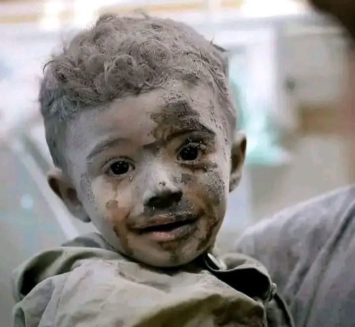 Astridueil's tweet photo. Do not talk about human rights..
Do not talk about international laws..
Do not talk about the world's humanity..
​Humanity died and was buried under this rubble,
and nothing is left of it except this face—which will haunt you all in your graves. https://t.co/GFW96RayGN