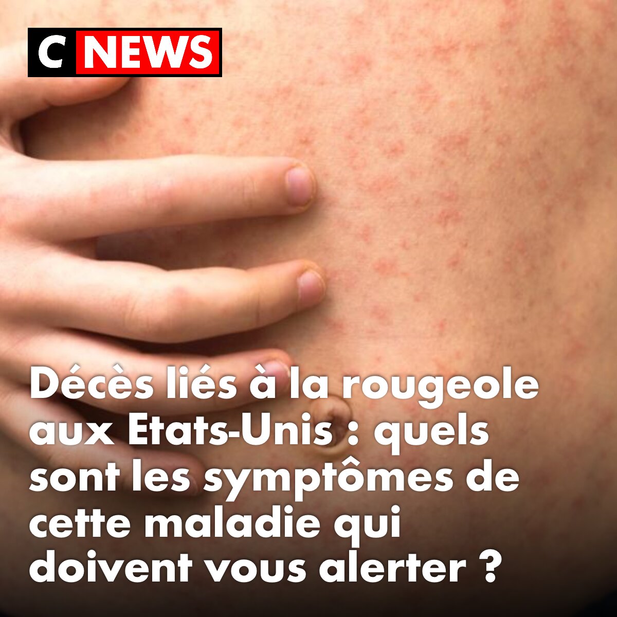 CNEWS's tweet photo. Cinq morts et plus de 3.650 cas aux États-Unis. ➡️ https://t.co/PhcsenBSbQ https://t.co/HuLvRHyIPh