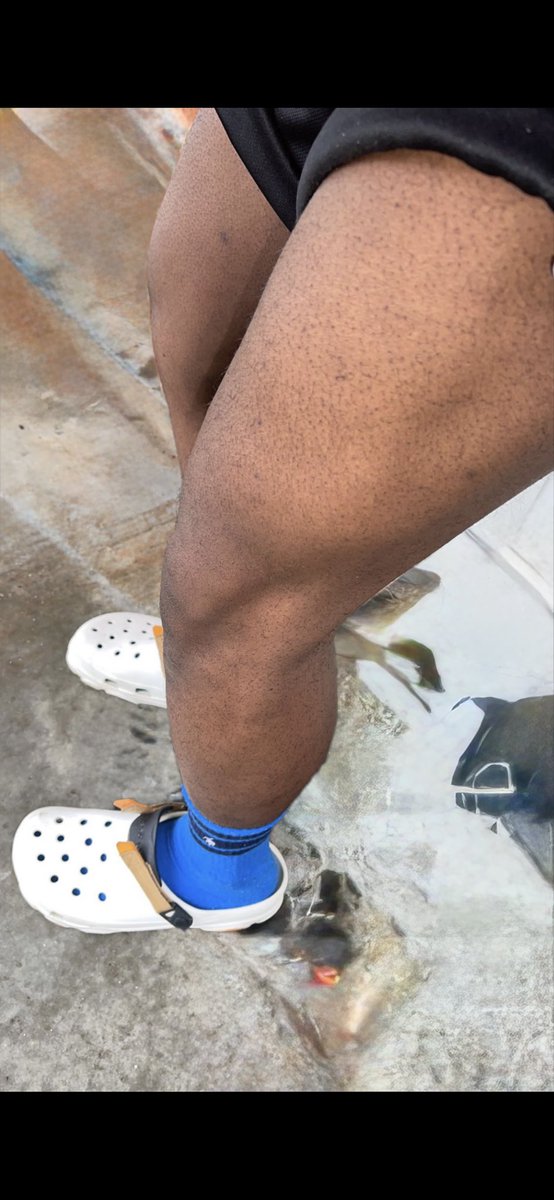 droochii's tweet photo. @droochii 🫡🤝built the entire project 15-25% body fat clean no enhancers. 

Off buffets, pig iron and general heavy equipment around. With the help of all the beautiful doctors ofc well as 2 of my fav builders. 223-200lbs flat

#droochii https://t.co/jlch7pHSDa