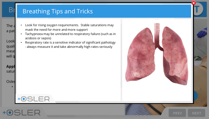 oslertech's tweet photo. A patient is acutely deteriorating on the ward.  What do you do?

Identifying, assessing and managing the acutely deteriorating patient is an essential skill for all hospital staff members.  

This free Osler module will walk you through the process.

https://t.co/YdMsLSH8fT

#FOAMed #tipsfornewdocs #juniordoctors #nurses #healthcare #medtwitter #meded