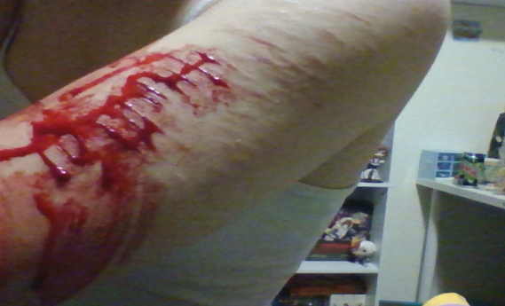 dEad_sErapHim1's tweet photo. SFX MAKEUP!! ALL FAKE
(ai enhanced, practice for halloween)
#shtwt #ouchietwt #sfxmakeup https://t.co/STcKjxxNUV