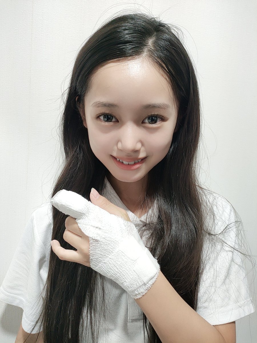 m_kokona_0909's tweet photo. 骨折しちゃってた🤣  ̖́-

コメントとかDMとかありがとうございます😭

痛み止めももらたから大丈夫です✌️

私の指があたった、あのカメラマンさんの頭は大丈夫なんやか？

 #天神娘 #天むす #渚ここな #ここな https://t.co/5ipo26rRI6