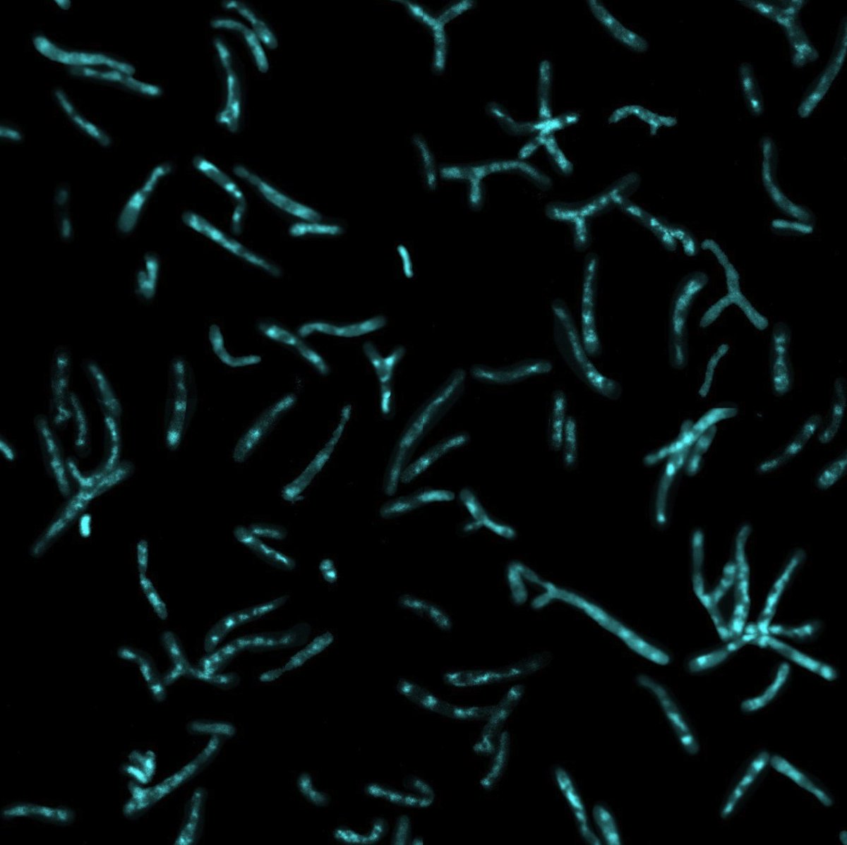 ScienceStowers's tweet photo. This week's #MicroscopyMonday shows digital collage of bacteroids, a special form of bacteria that lives inside alfalfa roots. 🔬🌱 @ErikaPinto96 (@SivaSankariIMS Lab) https://t.co/uVw5mAnuIG