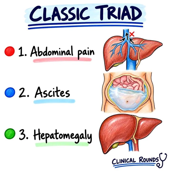 DoctorMed0's tweet photo. This triad is called as... https://t.co/ibJBJwcH0n