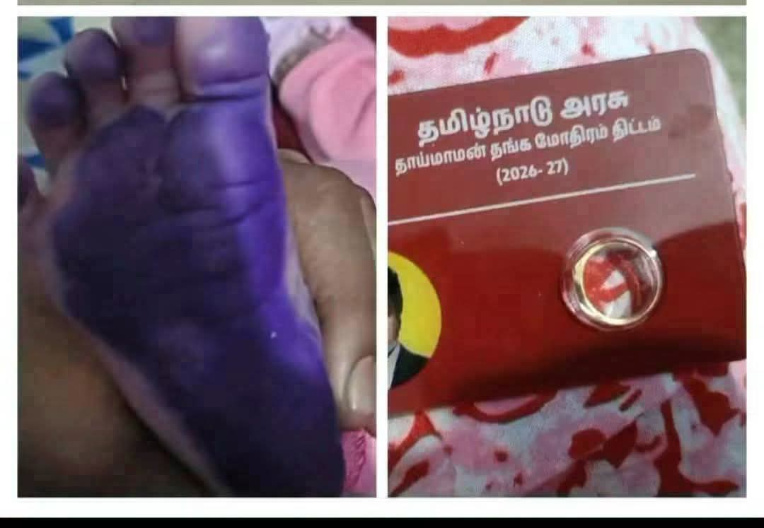 Amutha74247715's tweet photo. ஊரான் வீட்டு நெய் எடுத்து உன் பெயரை சொல்லி குழந்தைகளுக்கு ஒன்னுக்கும் உதவாத 18கேரட் பித்தளை மோதிரம் போட்டீங்க அதுவரைக்கும் ஓகே
மோதிரம் போட்டதுக்கு அடையாளமா பூ போன்ற பிஞ்சின் காலில் என்னத்தடா தடவி வச்சிருக்கீங்க?
உன் வீட்டுப் பிள்ளையா இருந்தா இப்படி தடவுவியா?
இந்த ஈனக்கூட்டம் ஒற்றை மோதிரத்திற்காக பிள்ளையின் காலில் சூடு போட்டாலும் ஏற்றுக்கொள்ளும்..!