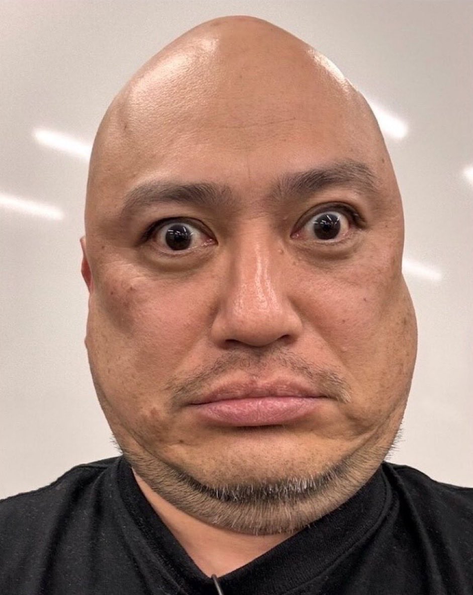 gottunn00's tweet photo. 相手のパンツ脱がしたらめっちゃブツブツできてた時の金玉 https://t.co/M4fYPtmEVz