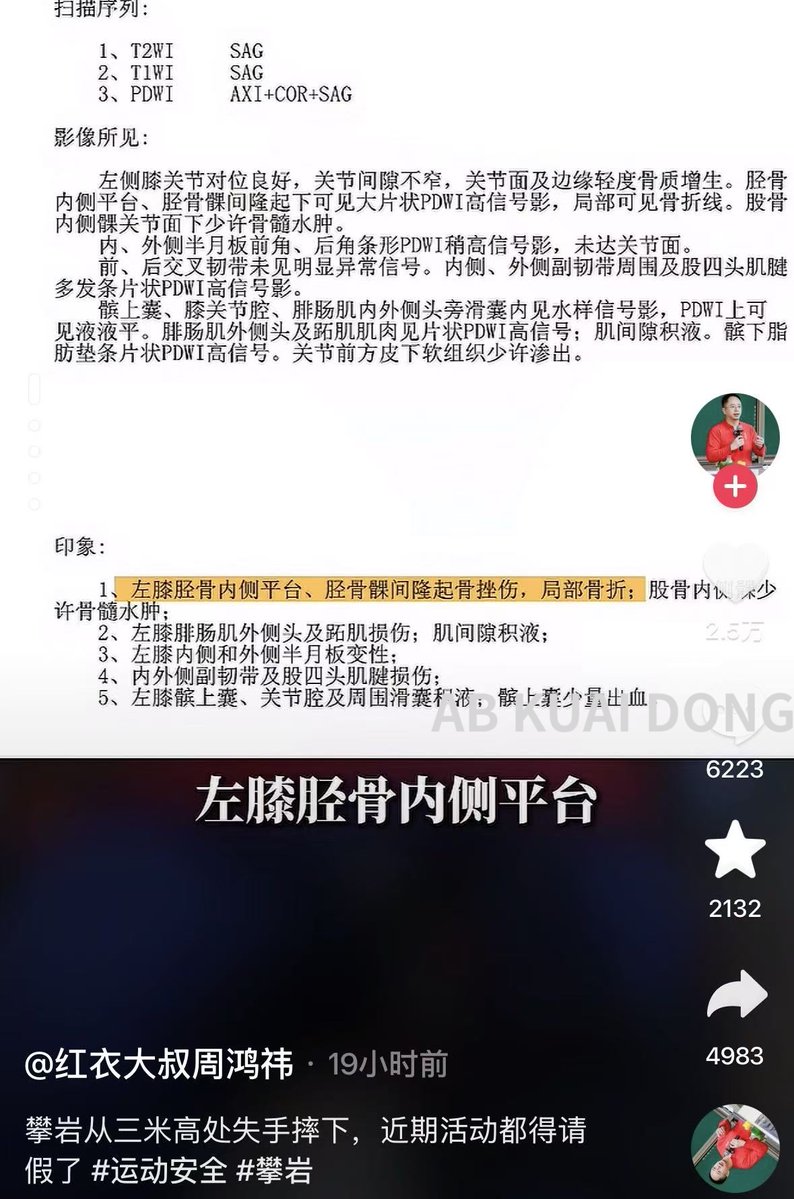 _FORAB's tweet photo. 这是多大仇？昨天 360 创始人、56 岁周鸿祎，被曝攀岩时从 3 米高摔下，左膝发生粉碎性骨折。

然后猎豹移动董事长傅盛，深夜朋友圈发文称苍天有眼，鸿膝当碎（寓意人在做，天在看，你活该。

而今年 3 月，傅盛还在微信群里，骂周鸿祎欠钱不还，还说被拉黑了 🤣 https://t.co/sU8GQoCdcf