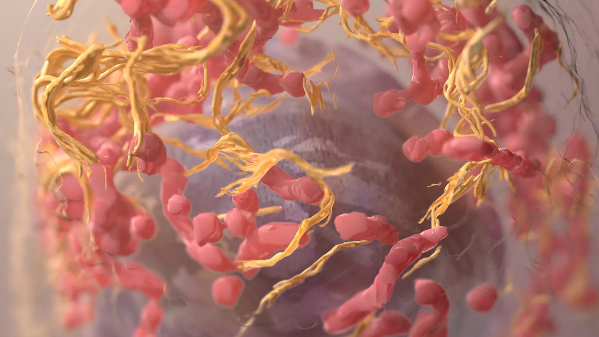 FrontOncology's tweet photo. New Research: Advanced stage at diagnosis and aggressive histology dominate prostate cancer presentation in Kenya: a registry analysis www.​frontiersin.​org/articles/10.​3389/fcacs.​2026.​1946844 #FrontiersIn #CancerControlSociety https://t.co/hQloNRxaBZ