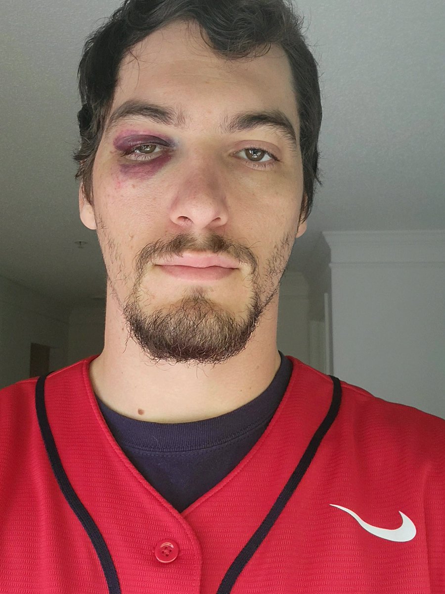 hernandezc4e's tweet photo. Update! Day 2 of #AustinRiley Homerun to the face. Phillies fan took the ball. Austin Riley, let me get a signed ball!
#EagleCatching #lvboyseonghyeon https://t.co/GG5saMgTk3