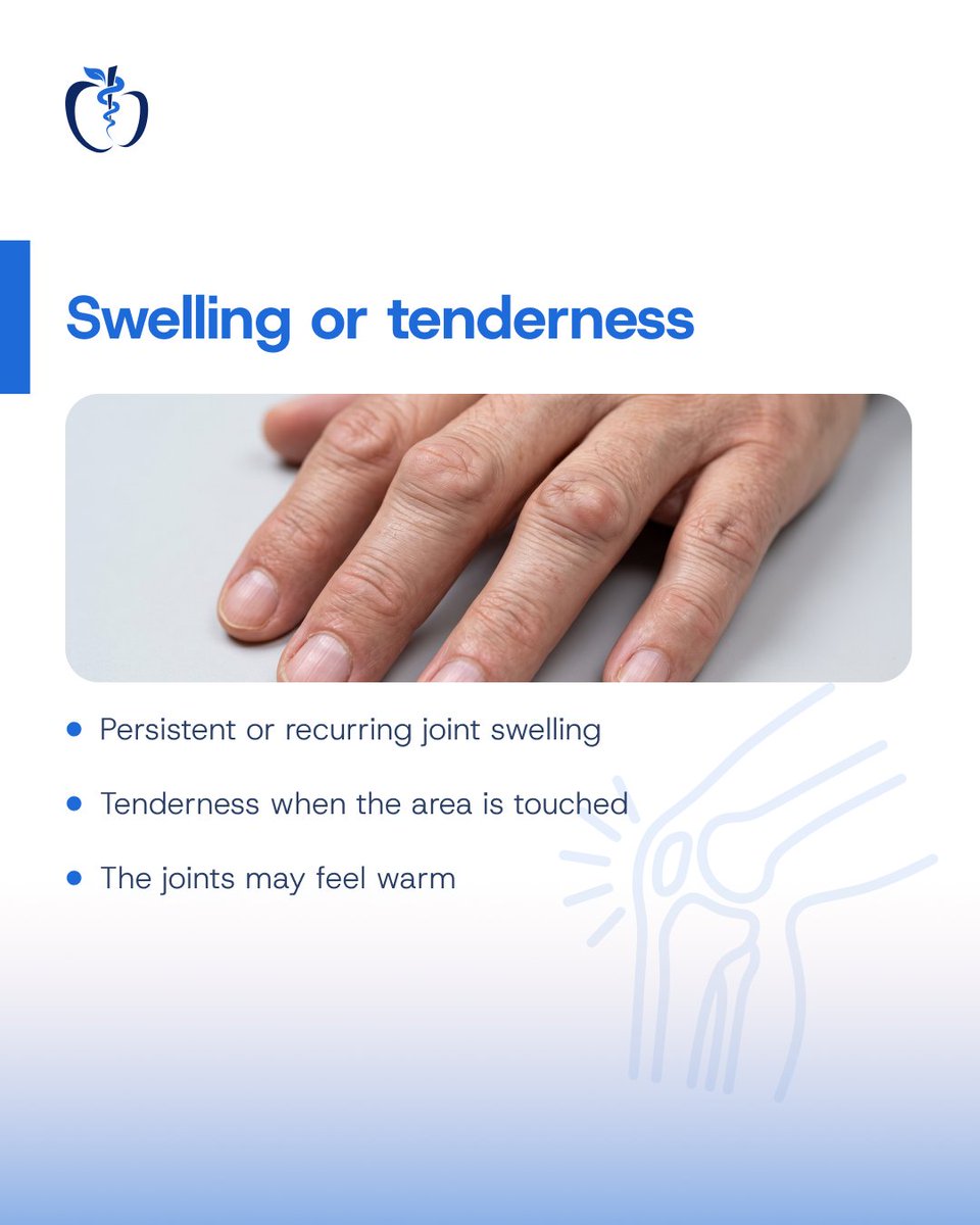 ADKHospital's tweet photo. Joint pain that keeps coming back, stiffness that lingers in the morning, or swelling that won't settle shouldn't be ignored.

Early diagnosed and the right treatment can help prevent permanent joint damaged. Swipe to learn when it's time to see a Rheumatologist

Book an appointment
Visit our MyCare portal at https://t.co/8qZ9WDncs7
Call 1440
or WhatsApp us at +960 767-1440