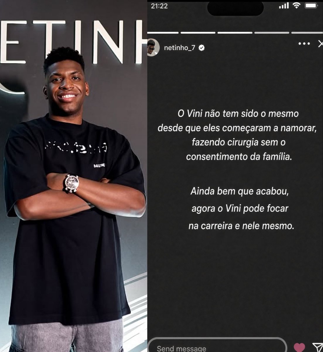 Femzyr0's tweet photo. Vinicius Jr.'s younger brother, Netinho, took to his Instagram Story to celebrate his brother's breakup with Virginia Fonseca though he deleted the post shortly after.

In the deleted story, Netinho said Vinicius hasn't been the same since they started dating. He claimed his brother stopped performing on the pitch the way he used to and stopped giving his family attention all because of her. The worst part, he said, was that she pushed Vinicius into getting facial surgery after constantly calling him ugly in public. He did it without telling any of the family  they only found out online.
Now that she's gone, Netinho says Vinicius will have more time to focus on his career and love his natural self again.