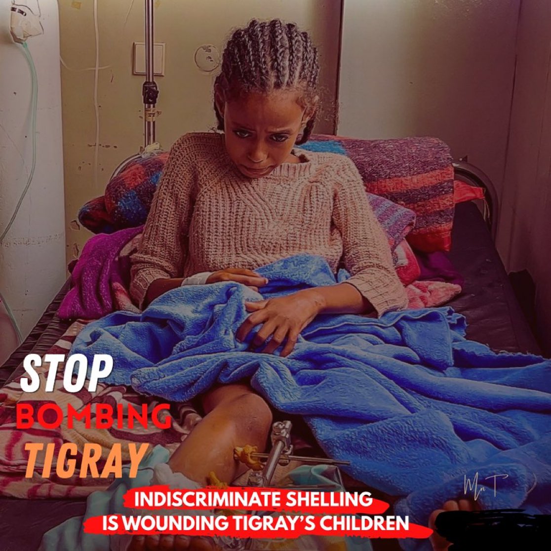 Eyerustg's tweet photo. #STOP INDISCRIMINATE SHELLING IN TIGRAY! Children are being killed and permanently injured. @USEmbassyAddis @EUCouncil @UN @IntlCrimCourt @eu_eeas @UN_HRC @eu_eeas @amnesty @amnesty @hrw, demand civilian protection and urgent international action. #Tigray #StopBombingCivilians 💔 https://t.co/bbZ3N0NFly