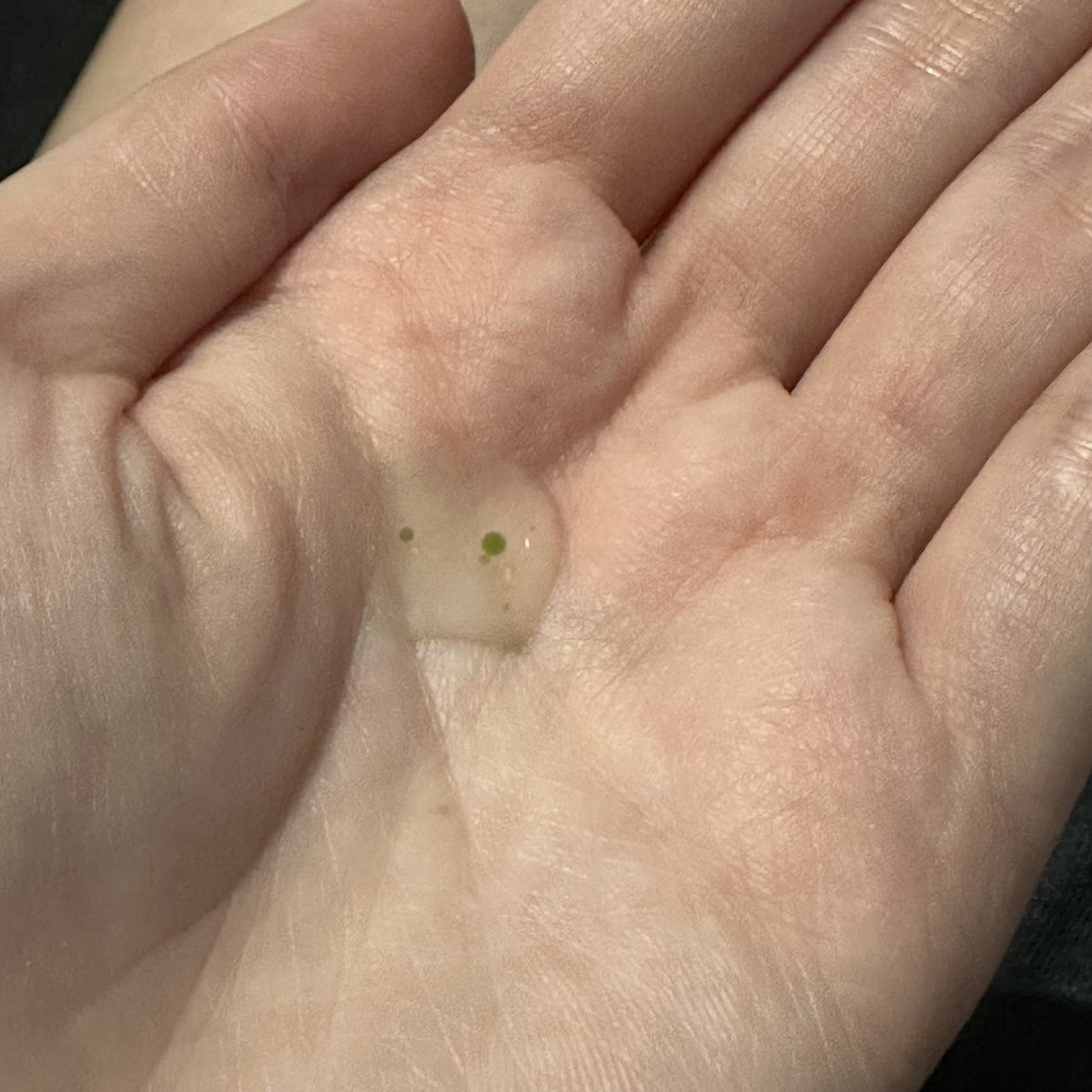 _cookingmother_'s tweet photo. 🍃季節の変わり目の抜け毛対策💆♀️
ヘティのスカルプアンプル!
キャップ外すとスポイトになってるからそのまま頭皮につけられて使いやすい❣️
乾かした後の髪の毛も重くなったりしないしベタベタもしないから助かる😚ほどよい清涼感があるよ!
#PR #頭皮ケア #ヘティ #HAETI #頭皮美容液 https://t.co/rzTPfW3dJX