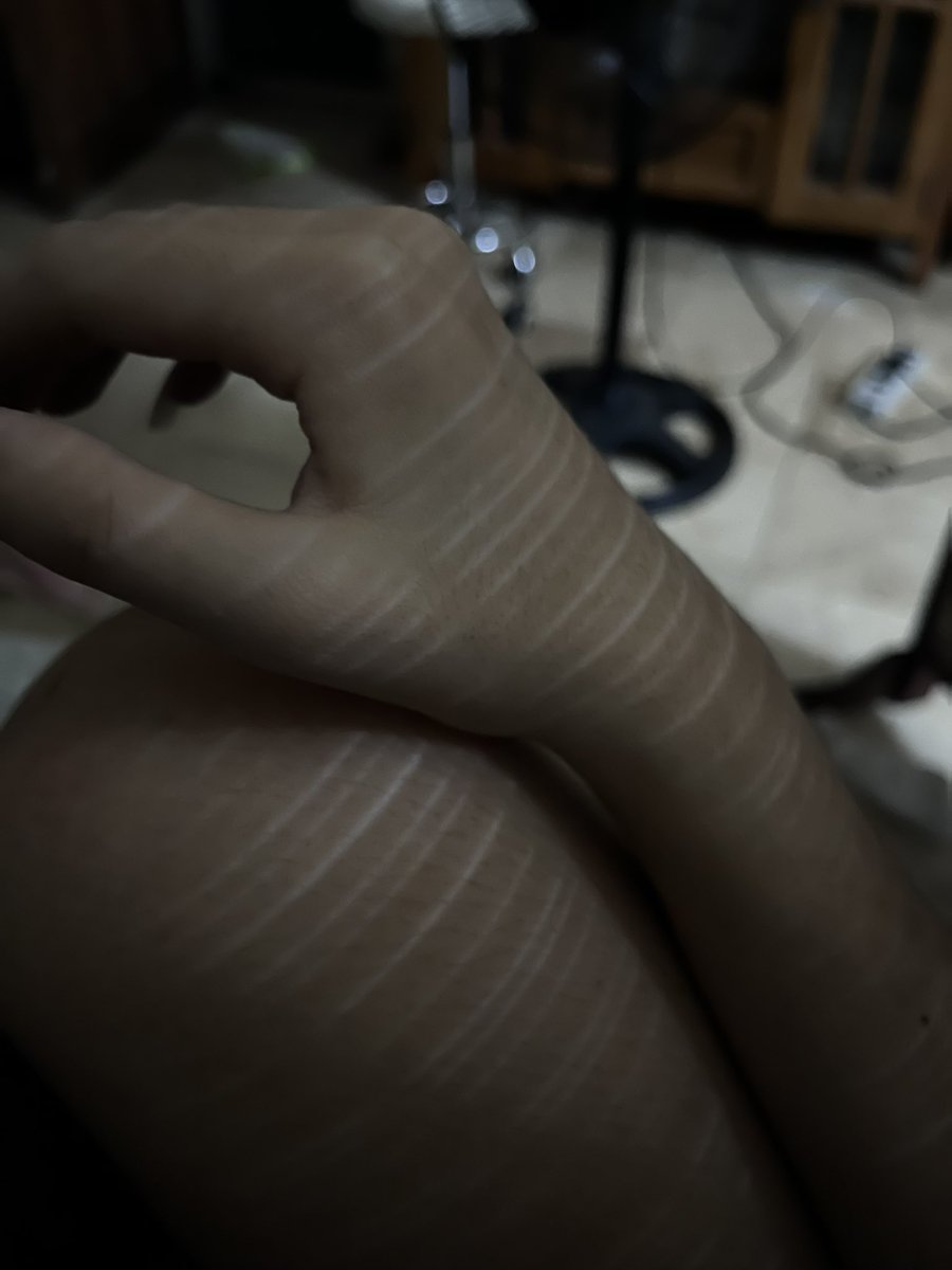 xeidLol's tweet photo. Lighting lowk cutspo
Twt fake scars it’s js shadows. https://t.co/0zJcvxgZXg