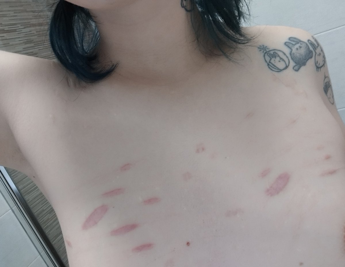 fugglerporro's tweet photo. SFX HALLOWEEN MAKEUP ALL FAKE
duelen pero son lindas #subtwt #nsfwtwt #scars #fake #shsh https://t.co/8gJJ3yVWbf