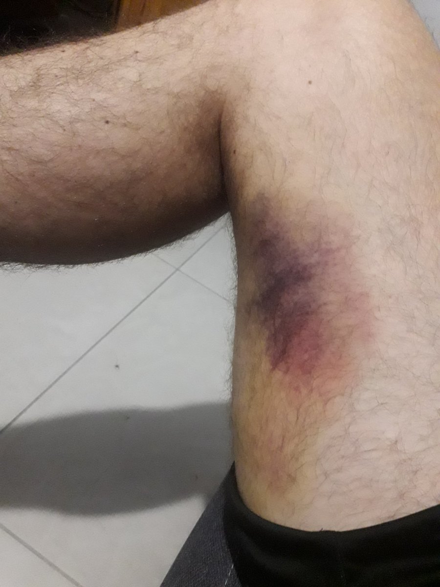 HSCharon's tweet photo. POV : tu te butes depuis 6 mois pour retrouver un niveau national au bad mais t'approches des 40ans...

j'ai bien fait de reprendre le poker, au pire je risque une chute du siège mais voila ^^ https://t.co/Z479JDMRB9